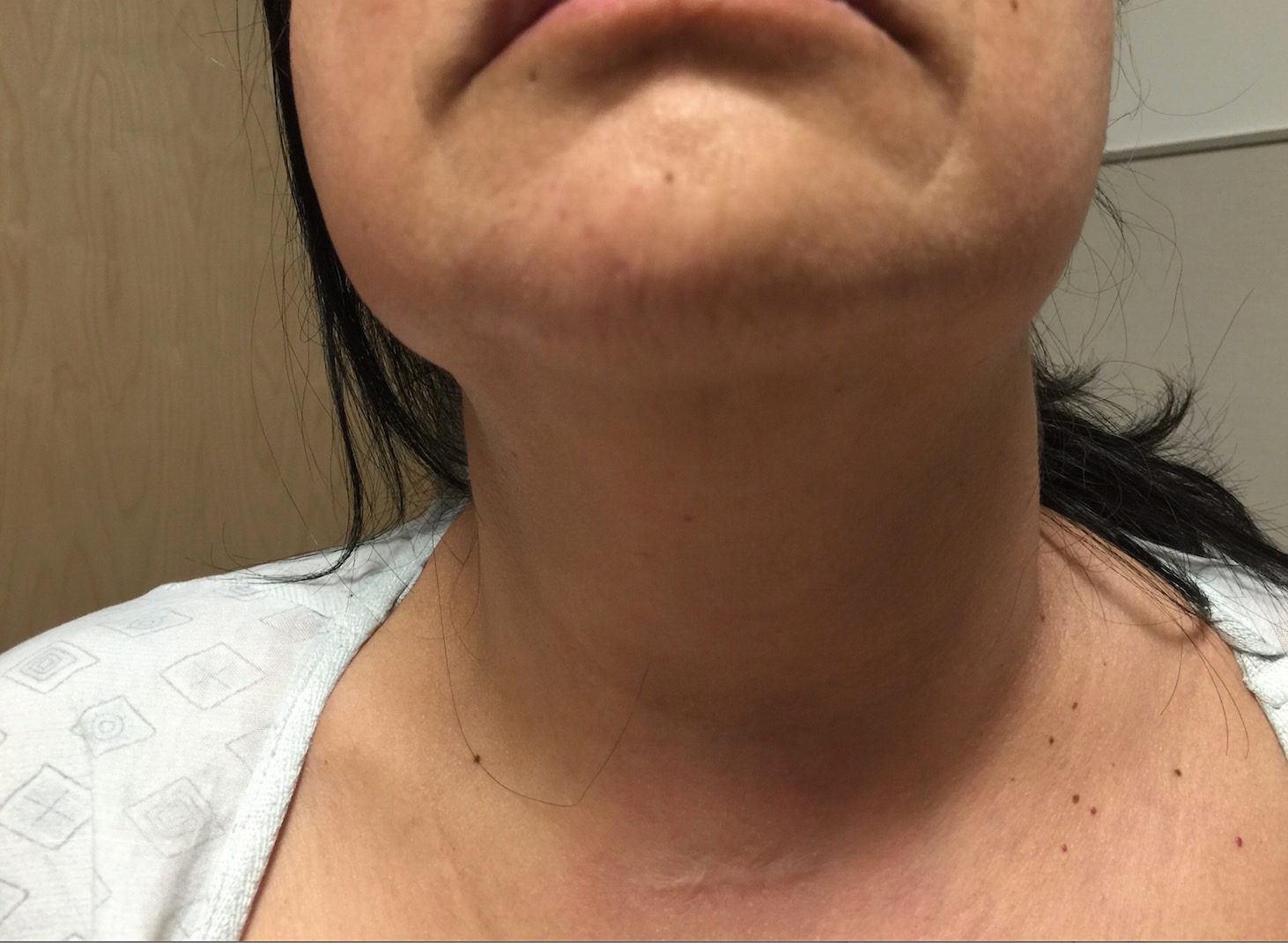 sore lymph nodes in neck